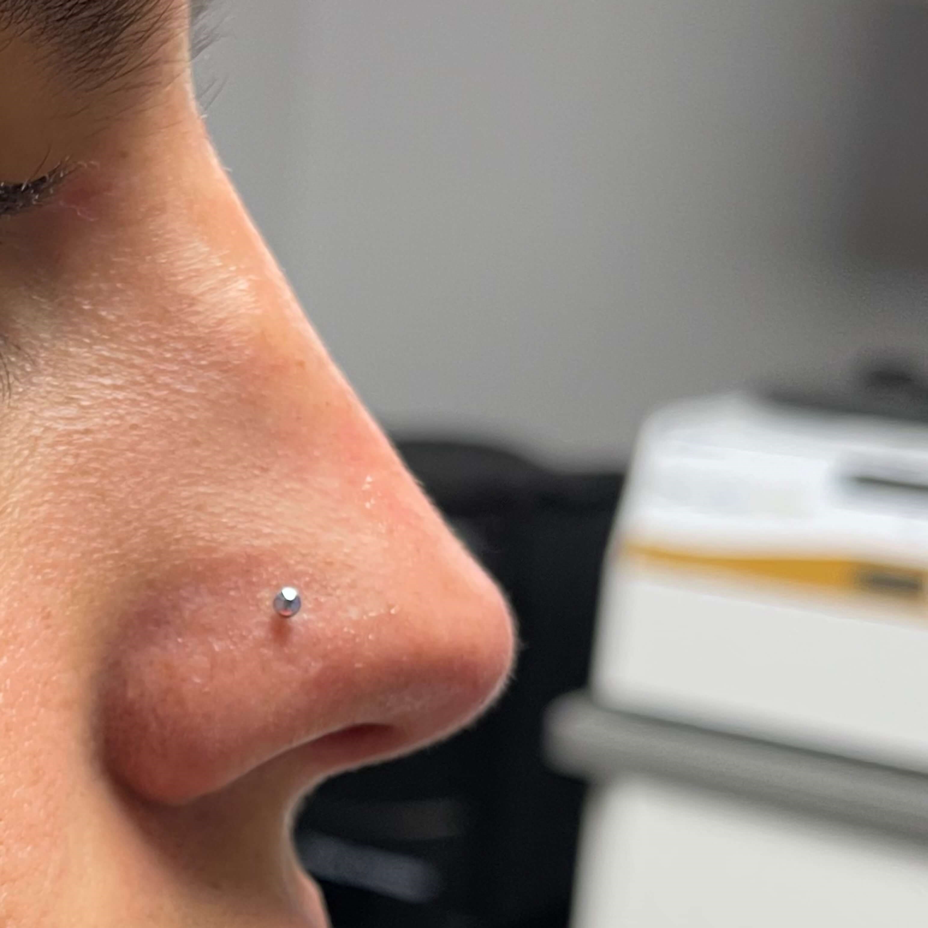 Non Surgical Rhinoplasty After